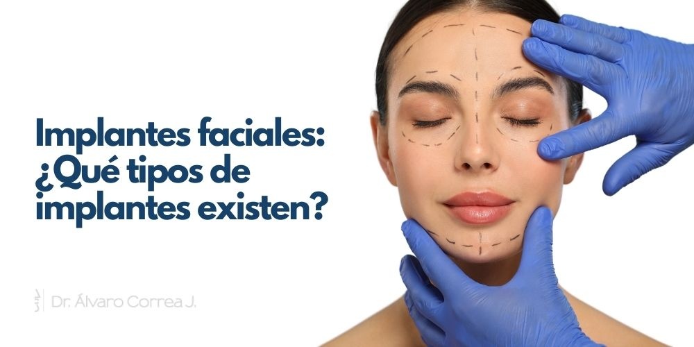 Implantes faciales: ¿Qué tipos de implantes existen?