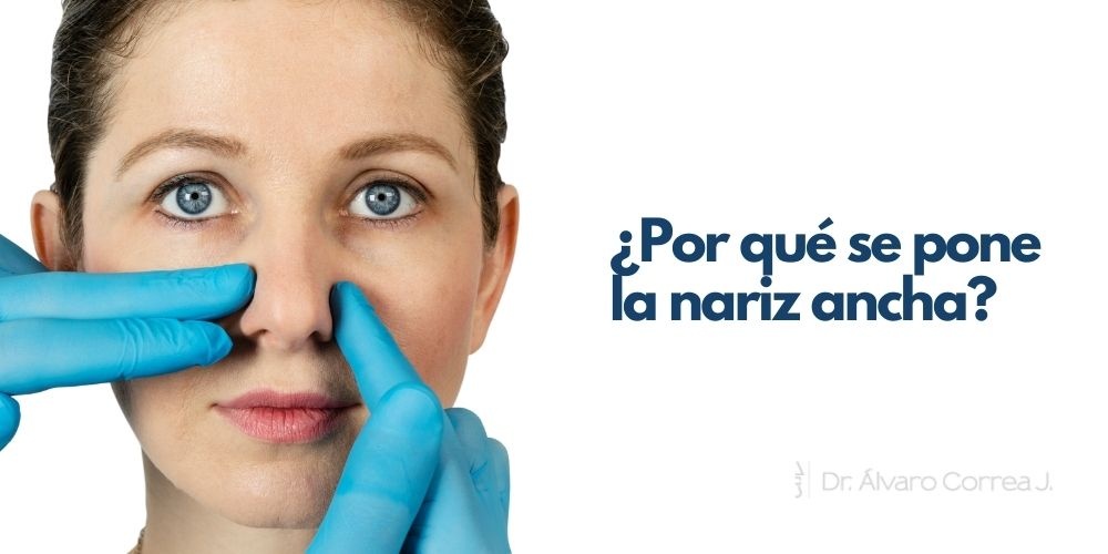 ¿Por qué se pone ancha la nariz?